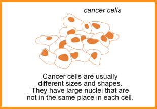 Cancer cell are usually different sizes and shapes. They have large nuclei that are not in the same place in each cell.